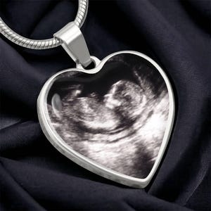 Baby On Ultrasound Custom Pendant Necklace Personalized Sonogram Photo Pregnancy Announcement Jewelry Gift for Expecting New Mom Keepsake