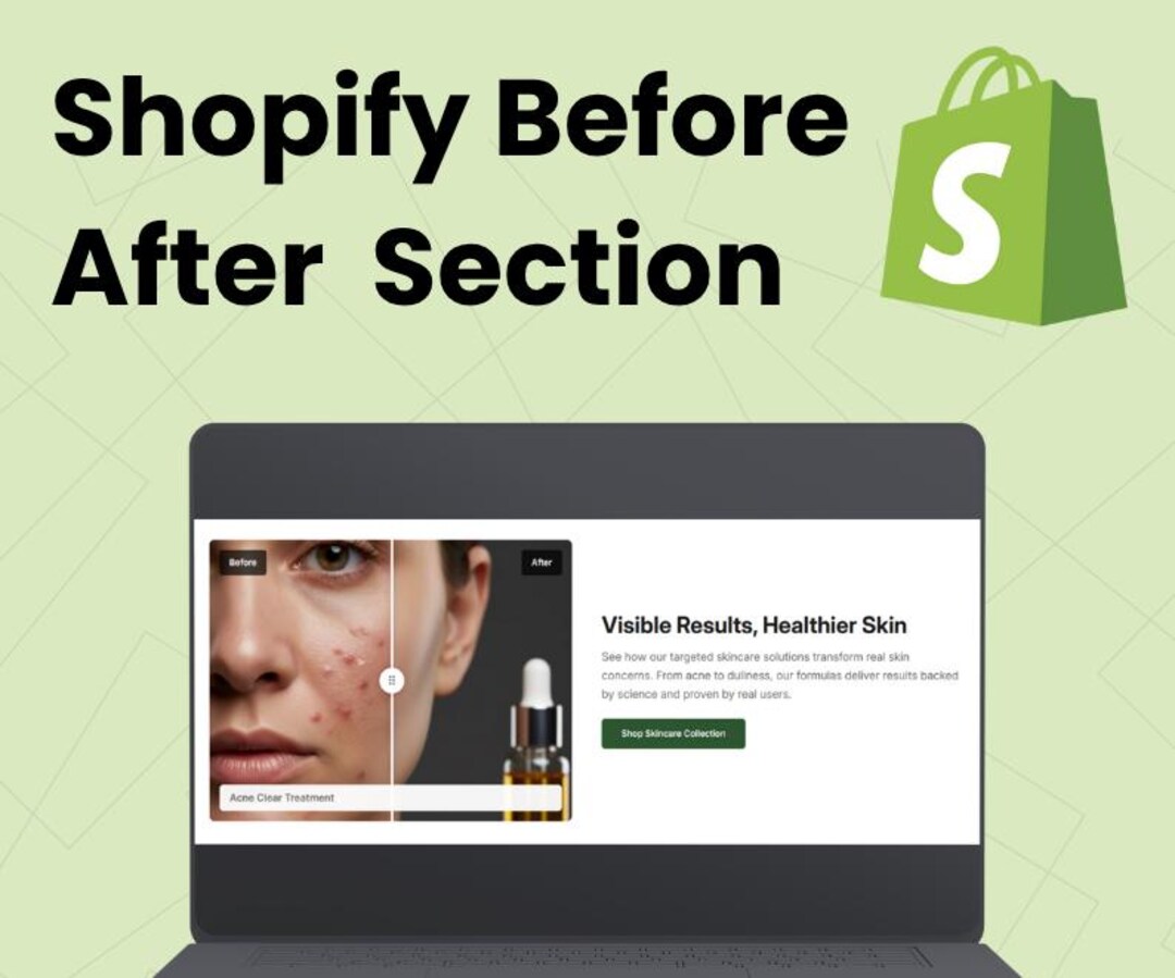 Shopify BEFORE & AFTER Image Comparison Slider Section | Theme ...
