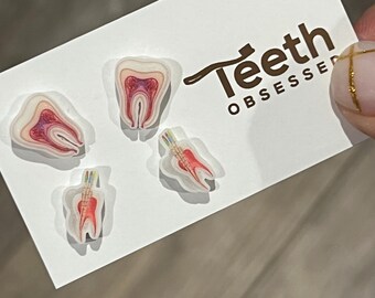 Root Canal Anatomy Earrings: Glitter Tooth Studs, Dental Gift