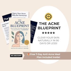 The Acne Blueprint | Natural Acne Healing Guide | Clear Skin Ebook for Hormonal, Cystic & Adult Acne, Gut and Hormone Reset