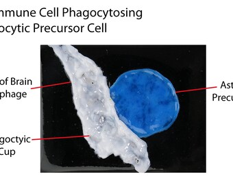 Brain Macrophage phagocytosing a Precursor Cell