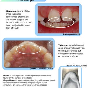Zahnhygiene Schülernotizen- Orofaziale Anatomie Teil 2