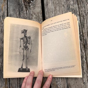 Pu&ograve; includere: Un libro aperto con pagine color crema che presenta una fotografia in bianco e nero di uno scheletro umano sulla pagina sinistra e testo stampato sulla destra. Il testo include il numero di pagina 149 e discute dello scheletro di Merrick.
