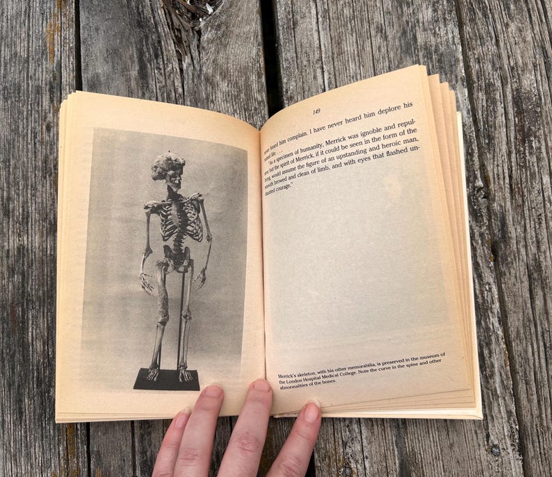 Pu&ograve; includere: Un libro aperto con pagine color crema che presenta una fotografia in bianco e nero di uno scheletro umano sulla pagina sinistra e testo stampato sulla destra. Il testo include il numero di pagina 149 e discute dello scheletro di Merrick.