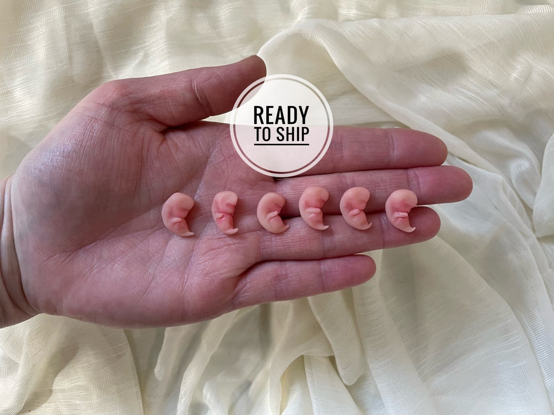 Miscarriage Pictures 4 6 Week Visual Comparison - kf2ms32