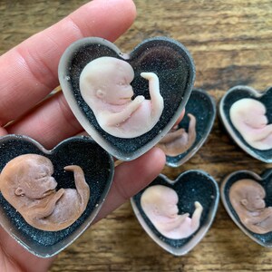 Ready To Ship 7 Week Gestation Embryo Memorial Honor Etsy Ready To Ship 7 Week Gestation Embryo Memorial Honor Etsy