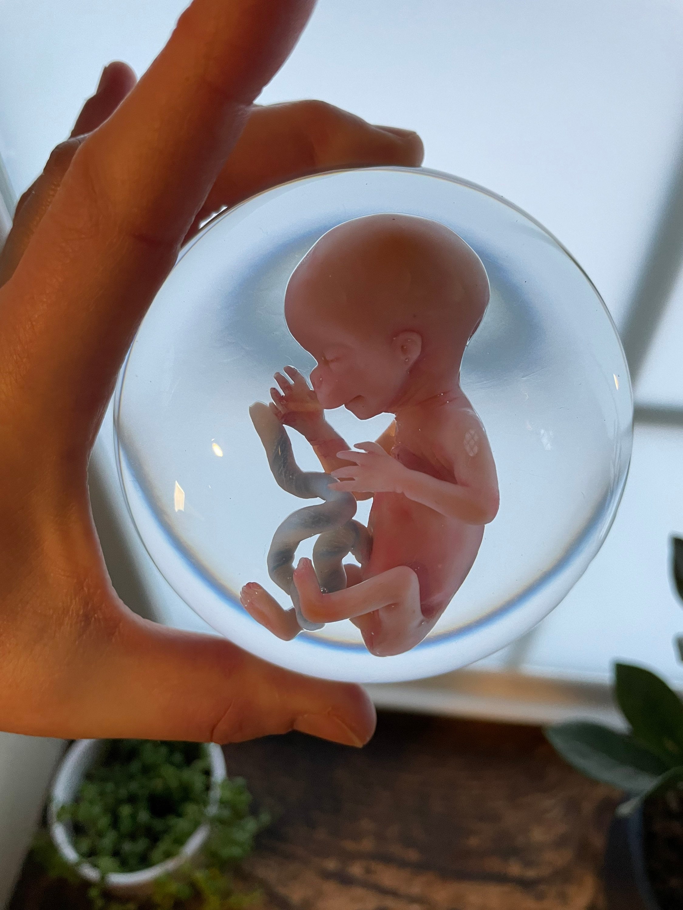 What Does An 8 Week Miscarried Fetus Look Like? - vvgnq2f