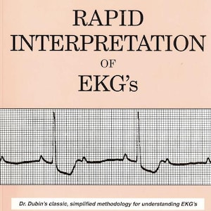 Rapid Interpretation of EKG&#39;s 6th Ed by Dale Dubin - Cardiac Rhythms, Arrhythmias & Clinical Guide PDF