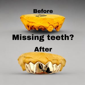 May include: An image showing a dental mold before and after a cosmetic procedure. The top mold is yellow, labeled "Before." The bottom mold, labeled "After," features gold-colored teeth. The text "Missing teeth?" is between the molds.