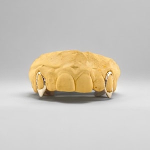 May include: A dental mold with two silver fang-shaped grillz. The mold is a light yellow color, and the grillz are attached to the canine teeth. The background is a solid, light gray.
