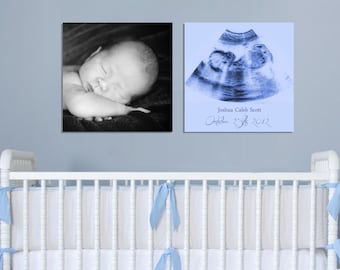 Ultrasound Gift, Sonogram Gift, Your Ultrasound Framed On Canvas, Personalized Nursery Art