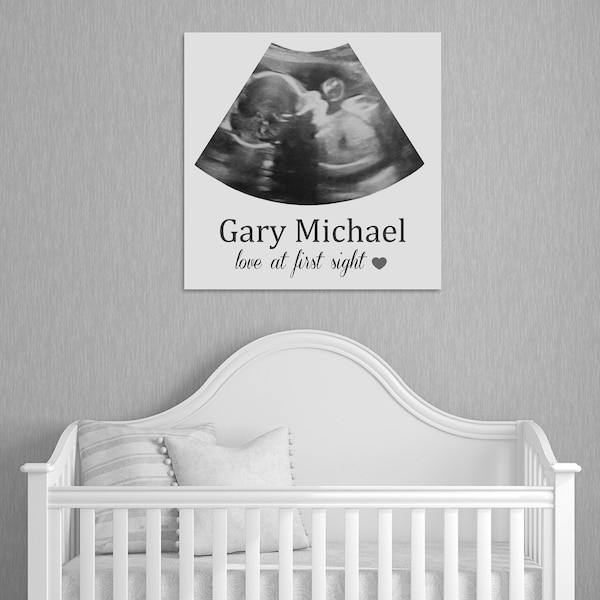 Personalized Sonogram Canvas Print: Nursery Ultrasound Wall Art