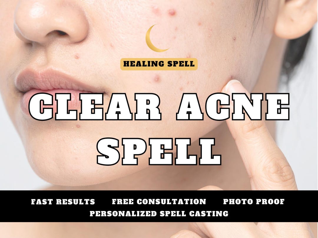 Clear Acne Spell, Skin Healing & Beauty Ritual, Remove Pimples, Glow up ...