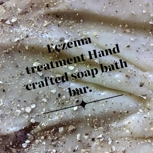 8oz. Eczema Soap Bars. for treatment of Eczema and psoriasis. We reccomend lathering soap on hands first, then applying to affected area. image 1