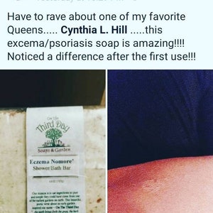 8oz. Eczema Soap Bars. for treatment of Eczema and psoriasis. We reccomend lathering soap on hands first, then applying to affected area. image 6