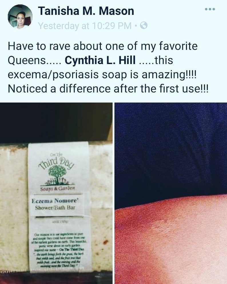 8oz. Eczema Soap Bars. for treatment of Eczema and psoriasis. We reccomend lathering soap on hands first, then applying to affected area. image 6