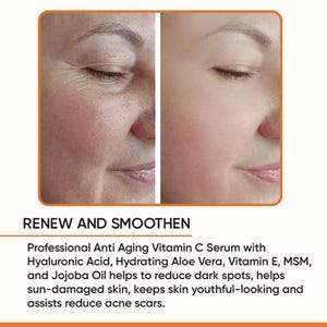 May include: Image showing a side-by-side comparison of a woman's face before and after using a skincare product. The left side shows visible wrinkles and uneven skin tone, while the right side appears smoother and brighter. Text reads: RENEW AND SMOOTHEN.