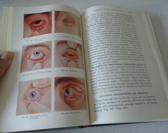 1949 May's Manual of Diseases of the Eye Opthamology Optometry Medical Book