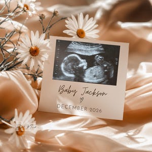 Può includere: Un biglietto di annuncio di gravidanza con un'immagine ecografica, il nome "Baby Jackson" e la data "DICEMBRE 2026." Il biglietto è circondato da margherite bianche con centri gialli, su uno sfondo di morbido tessuto color pesca.