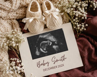 Minimalist Gender Neutral Pregnancy Reveal | Modern Ultrasound Baby Announcement | Editable Sonogram Canva Template