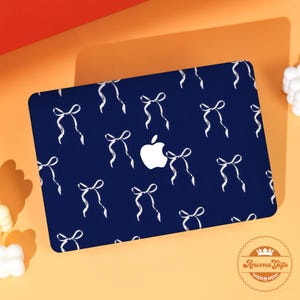 May include: A navy blue laptop case featuring a repeating pattern of white ribbon bows. The Apple logo is visible in the center. The case is on an orange surface. The brand name "Anoma Gifts" is in the lower right corner.