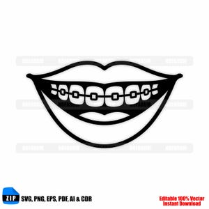 May include: Black and white illustration of a smiling mouth with braces. The image includes the text "ZIP SVG, PNG, EPS, PDF, AI & CDR" and "Editable 100% Vector Instant Download".