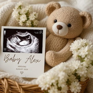 Elegant Pregnancy Announcement Template, Neutral Spring Ultrasound Card, White Floral Baby Reveal, Expecting Baby News, Digital Download