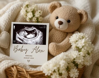 Elegant Pregnancy Announcement Template, Neutral Spring Ultrasound Card, White Floral Baby Reveal, Expecting Baby News, Digital Download