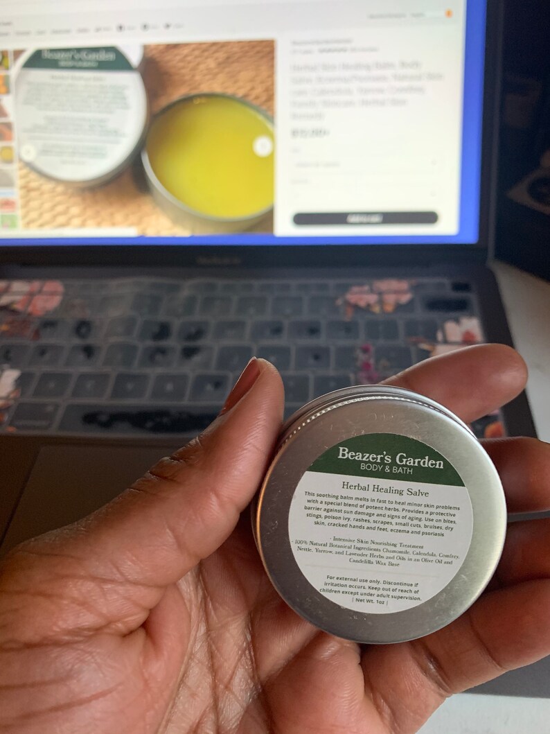 Herbal Skin Healing Balm Body Salve Eczema/Psoriasis Etsy