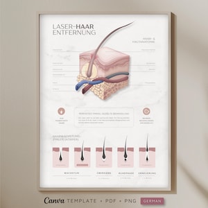 Op de afbeelding: Een educatieve poster getiteld LASER-HAAR ENTFERNUNG met een dwarsdoorsnede van de menselijke huidanatomie, haarzakjes en bloedvaten. Het bevat een schema van de haargroeicyclus met de fasen WACHSTUM, ÜBERGANG, RUHEPHASE en ERNEUERUNG.