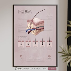 Op de afbeelding: Een poster getiteld LASER-HAAR ENTFERNUNG met een dwarsdoorsnedediagram van de menselijke huidanatomie met een haarzakje, bloedvaten en een gedetailleerd schema dat de haargroeicyclusfasen WACHSTUM, OBERGANG, RUHEPHASE en ERNEUERUNG illustreert.