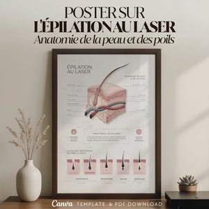 Op de afbeelding: Een ingelijste poster met de tekst "POSTER SUR L'ÉPILATION AU LASER Anatomie de la peau et des poils." De poster toont een illustratie van huidlagen, haar groeistadia en de tekst "ÉPILATION AU LASER".