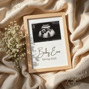 Neutral Pregnancy Announcement  Digital Baby Announcement, Social Media Pregnancy Reveal, Editable Canva Template,Gender Neutral Baby Reveal