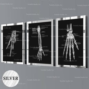 Set 3 Hand Bones Posters Hand Diagram Orthopedic Art Skeletal Bones Print Medical Art Scientific Art Orthopedic Surgeon Gift Clinic Decor