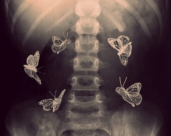 X Ray Photograph, Stomach, Butterflies, Fine Art, Bones, Skeleton, Photo, Print, Dark, Medical, Doctor, Surreal, Home Decor, Art, Halloween