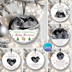 Pacote com mais de 6 enfeites personalizados para ultrassom, designs de enfeites com fotos de ultrassom, enfeites com nome personalizado em PNG, enfeites de Natal, presentes para gestantes em PNG.