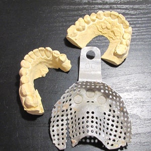 Vintage Set of Teeth Impression Mold Tray Plaster Cast of Real Human Teeth Art Jewelry Supplies Medical Research Dental Teeth Geekery (M525)