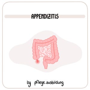Puede incluir: Ilustración del sistema digestivo humano con el apéndice resaltado en rojo, mostrando la ubicación de la apendicitis. El texto "APPENDICITIS" está en la parte superior de la imagen. El texto "by pflege.ausbildung" está en la parte inferior de la imagen.