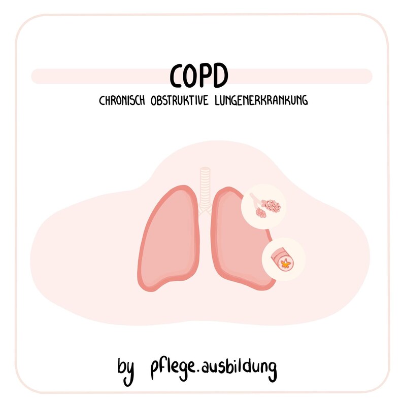 May include: An illustration of lungs with the text "COPD" and "CHRONISCH OBSTRUKTIVE LUNGENERKRANKUNG" above the lungs. The illustration shows the lungs with inflamed bronchioles and mucus buildup. The text "by pflege.ausbildung" is at the bottom of the image.