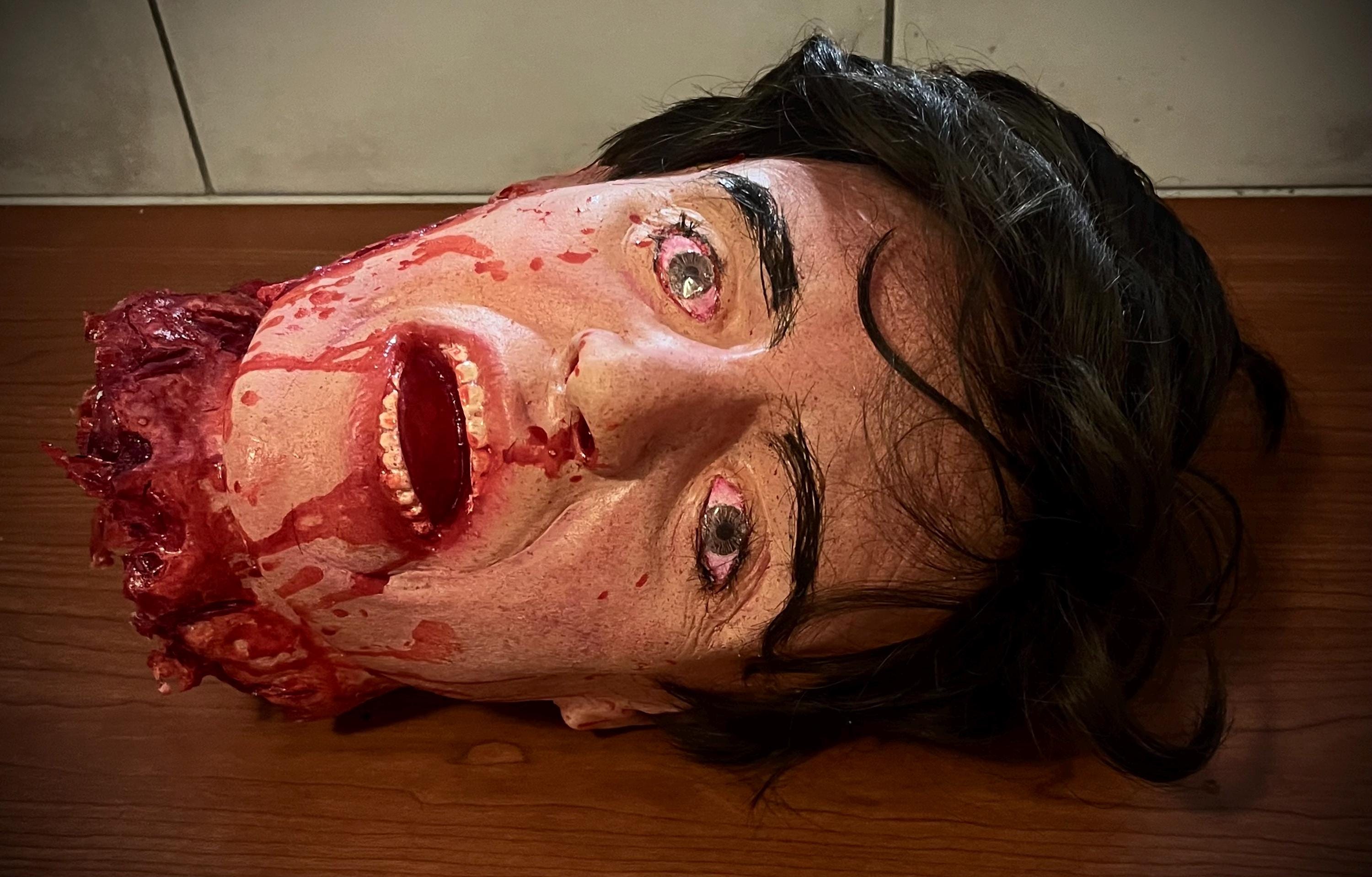 Hallazgos anormales en la exploración del abdomen, image size:3000x1918