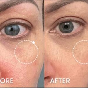 Peut inclure: Une image divis&eacute;e montre un gros plan du visage d'une personne, avec le c&ocirc;t&eacute; gauche &eacute;tiquet&eacute; "AVANT" et le c&ocirc;t&eacute; droit &eacute;tiquet&eacute; "APR&Egrave;S". Le c&ocirc;t&eacute; "AVANT" montre des rougeurs et des imperfections, tandis que le c&ocirc;t&eacute; "APR&Egrave;S" appara&icirc;t plus lisse et plus uniforme.