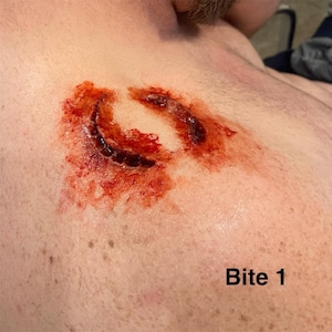 Zombie Bite | Silicone Prosthetic | SFX Makeup | Halloween | Cosplay