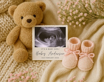 Baby Girl Announcement: Ultrasound Photo, Social Media Pregnancy Reveal (Canva Template Digital Download