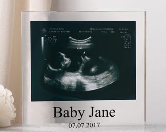 Gepersonaliseerde babyscan foto acrylplaat, aangepaste foto en berichtplaquette, kraamcadeau, echografie zwangerschapscan print, babyscan cadeau