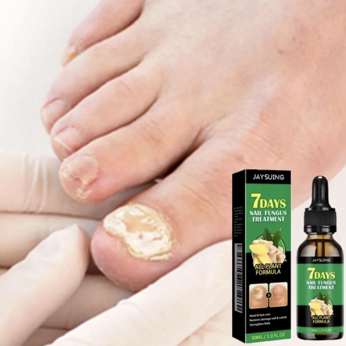 7 Day Nail Fungus Treatment and Cuticle Repair Oil Strengthens and