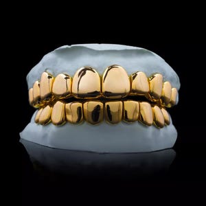 May include: A set of gold-coloured teeth grillz, displayed on a light blue dental mould. The grillz are highly polished, reflecting light, and are designed to cover the upper and lower teeth. The background is solid black.