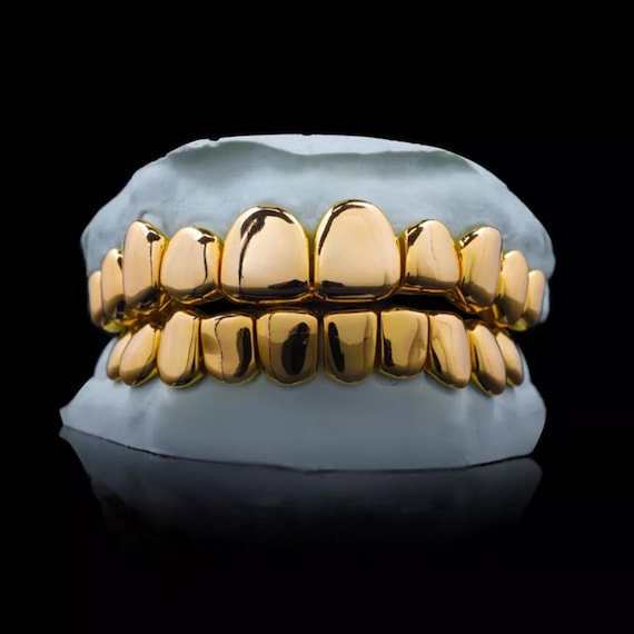 Custom Gold Grillz Dental (NPG-gold plated in 24k) Solid NPG Dental Gold Substitute Perm Cut/Deep Cut Solid Gold Grillz Teeth Caps