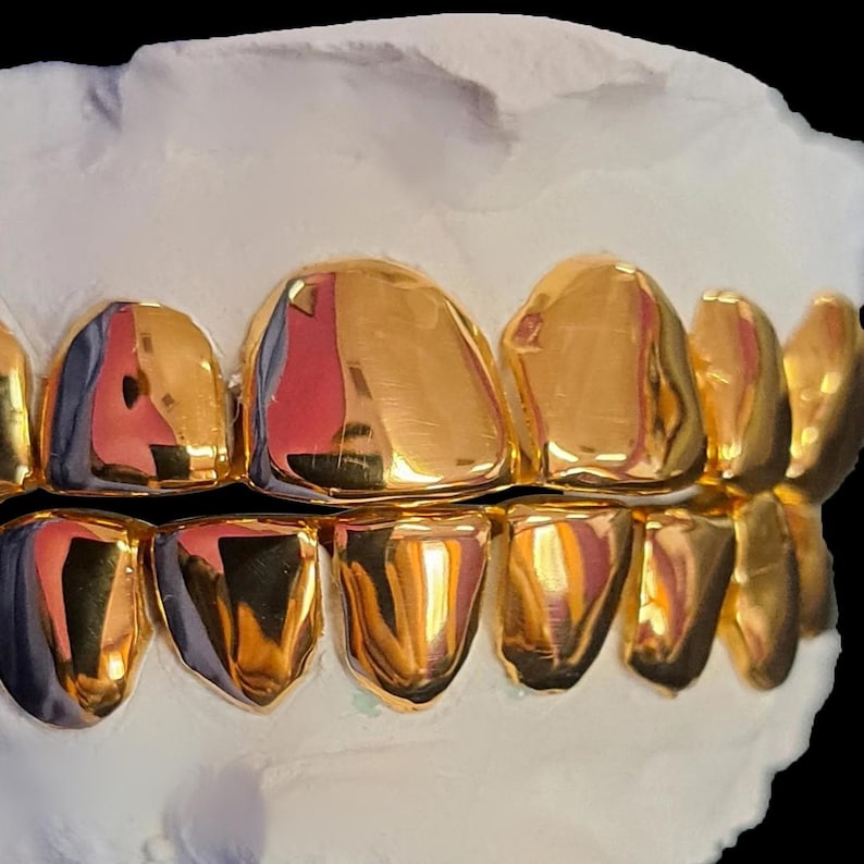 May include: A set of gold-colored dental grills, showcasing a full set of upper and lower teeth. The grills are highly polished, reflecting light, and are set against a white mold. The background is black.