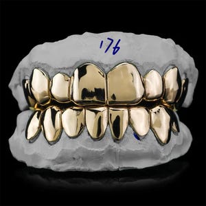 Könnte beinhalten: Ein Satz goldfarbener Zahn-Grillz, präsentiert auf einem weißen Zahnabdruck. Die Grillz haben eine glänzende, reflektierende Oberfläche. Die Nummer "176" ist mit blauer Tinte auf dem Abdruck geschrieben.