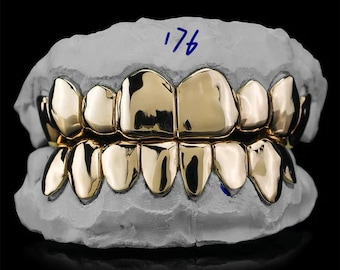 Puede incluir: Un juego de grillz dorados, exhibidos sobre un molde dental blanco. Los grillz tienen una superficie brillante y reflectante. El número "176" está escrito con tinta azul en el molde.